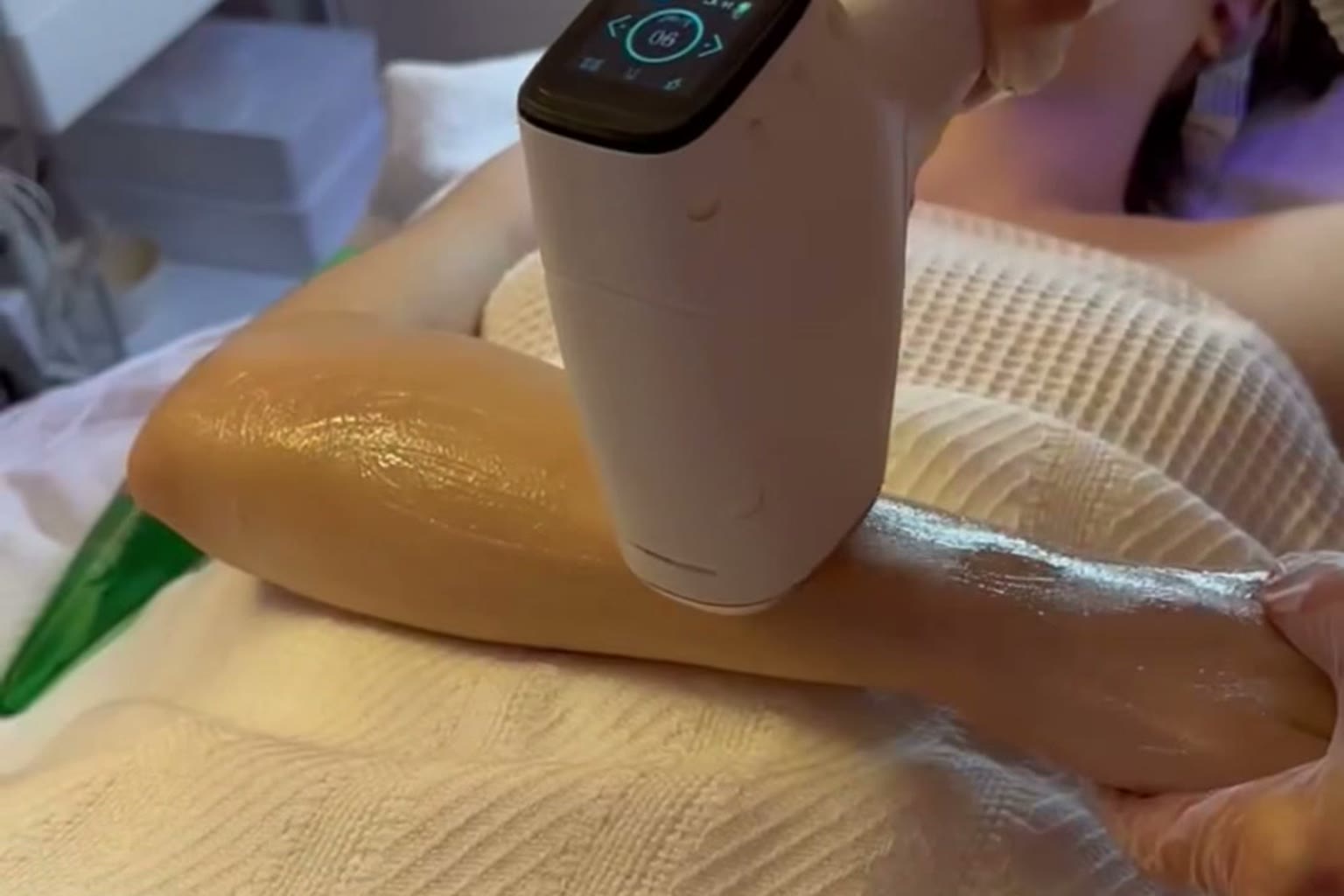 Provider performing laser hair removal on a client’s leg in a treatment room